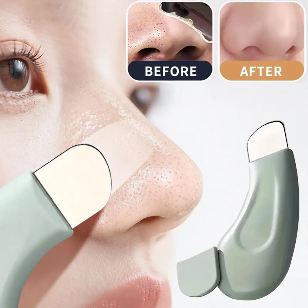 Yüzdeki Siyah Noktaları Temizl - Nasal Aspirator incelemesi ve fiyatı